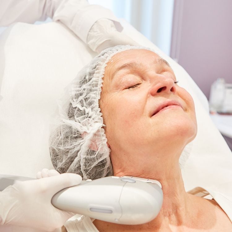 mulher deitada com tratamento ultraformer no rosto