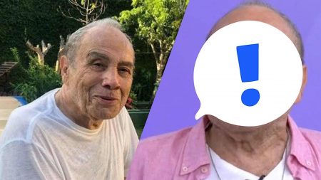Stênio Garcia passa por harmonização facial.