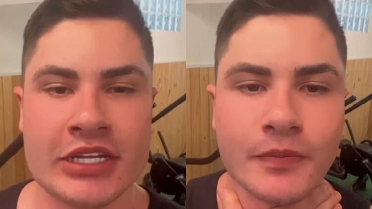 Lucas Souza, de A Fazenda 2023, mostrando o resultado de sua harmonização facial no instagram