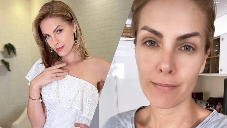 Ana Hickmann volta para as redes sociais.
