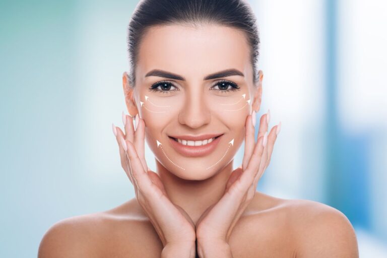 mulher com mãos no rosto e setas indicando lifting facial