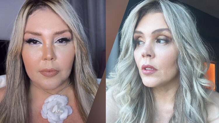Simony abre o coração sobre inchaço no rosto.