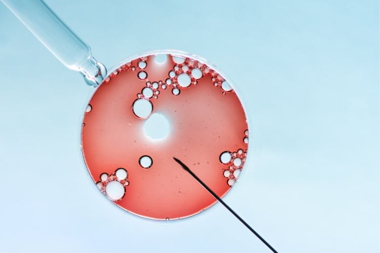 Placa de Petri com óvulo para ser fecundado