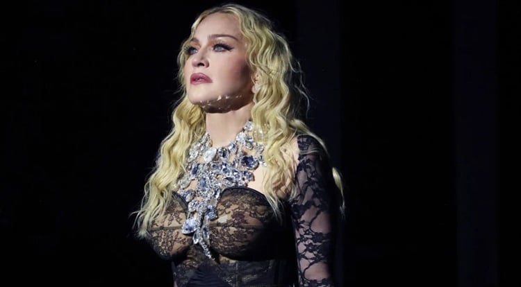Madonna teria feito diversas cirurgias plásticas