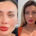 Andressa Urach se arrepende de cirurgia para mudar a cor dos olhos