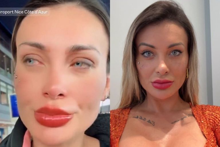 Andressa Urach se arrepende de cirurgia para mudar a cor dos olhos