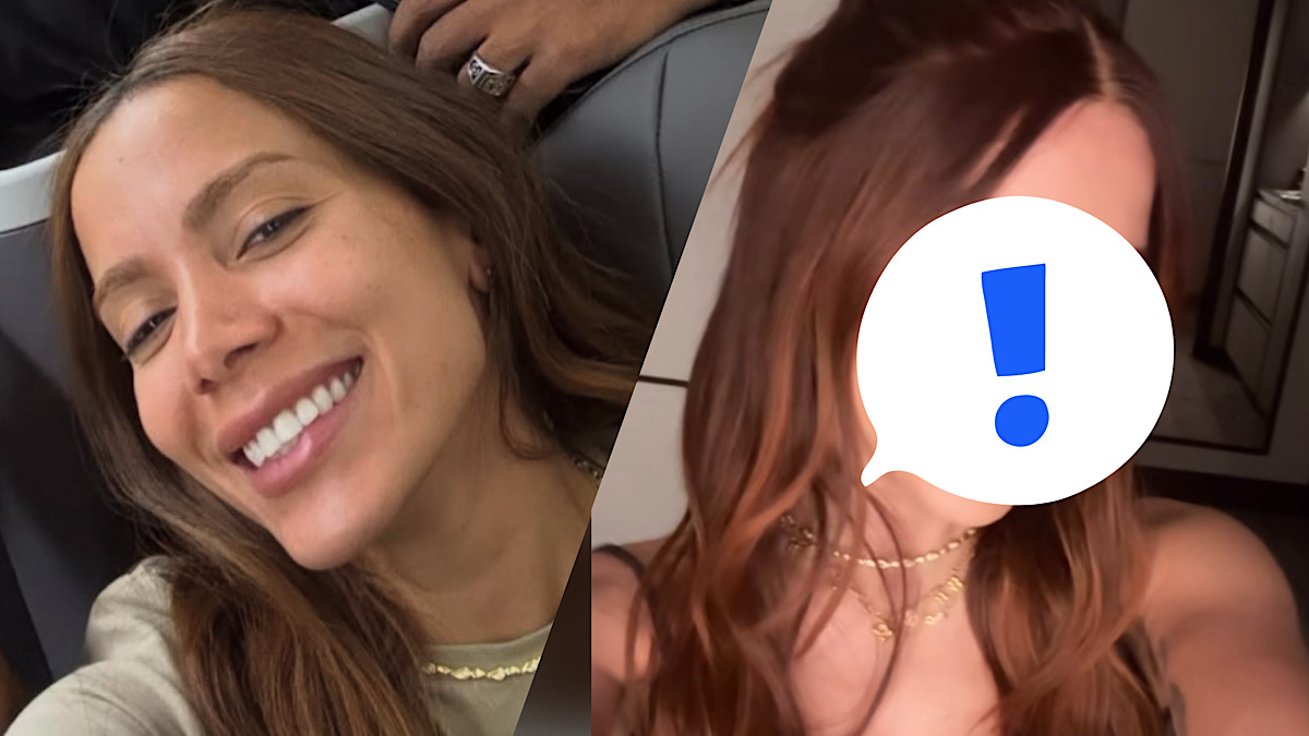 Anitta surge com o rosto diferente após procedimentos estéticos.
