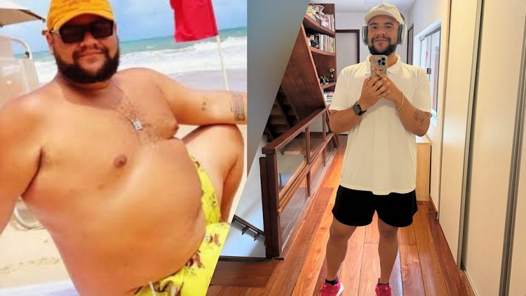 Gominho mostra antes e depois de perder 61 kg.