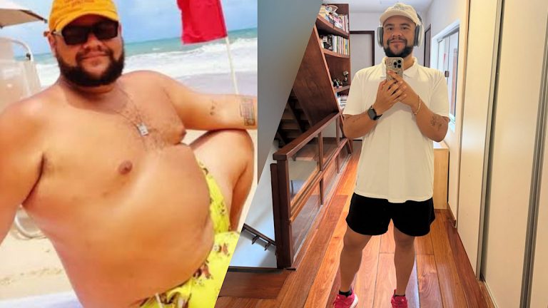 Gominho mostra antes e depois de perder 61 kg.